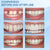 Resin Tooth Repair Glue Shapeable Teeth Gaps Filling Solid Glue Temporary Teeth Repair